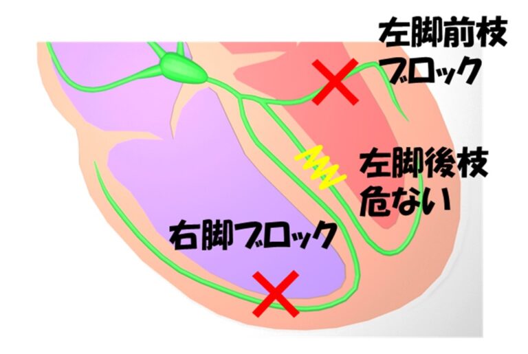  MBB が機能しない場合はどうすればよいですか?